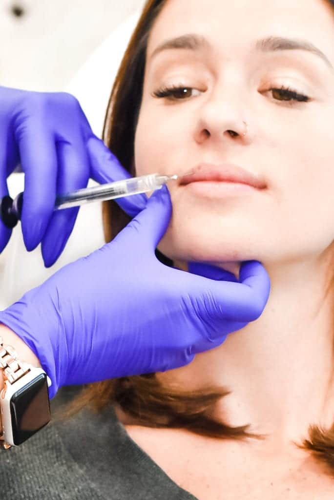 Portfolio 7 Dermal Filler Injections By Glow Med Spa of 30A