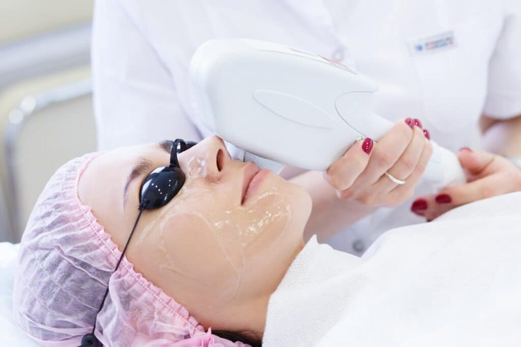 Portfolio 9 Laser Skin Treatment By Glow Med Spa of 30A