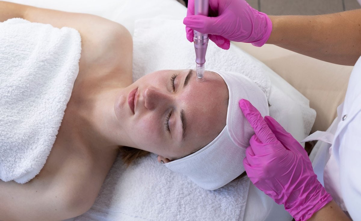Microneedling-By-Glow-MedSpa-Of-30A-in-Santa-Rosa-Beach-FL