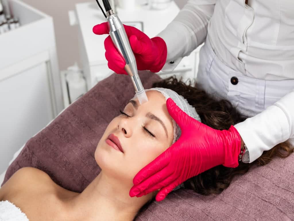 Can Microneedling Help with Large Pores? 1 Microneedling-By-Glow-MedSpa-Of-30A-in-Santa-Rosa-Beach-FL