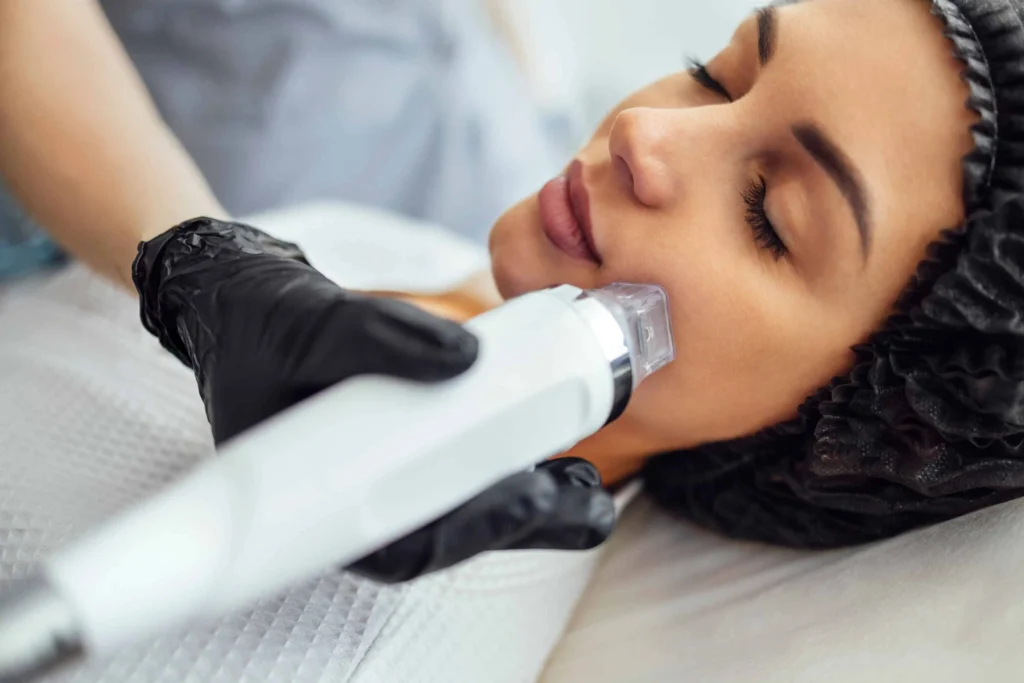 Virtue RF Microneedling in Santa Rosa Beach