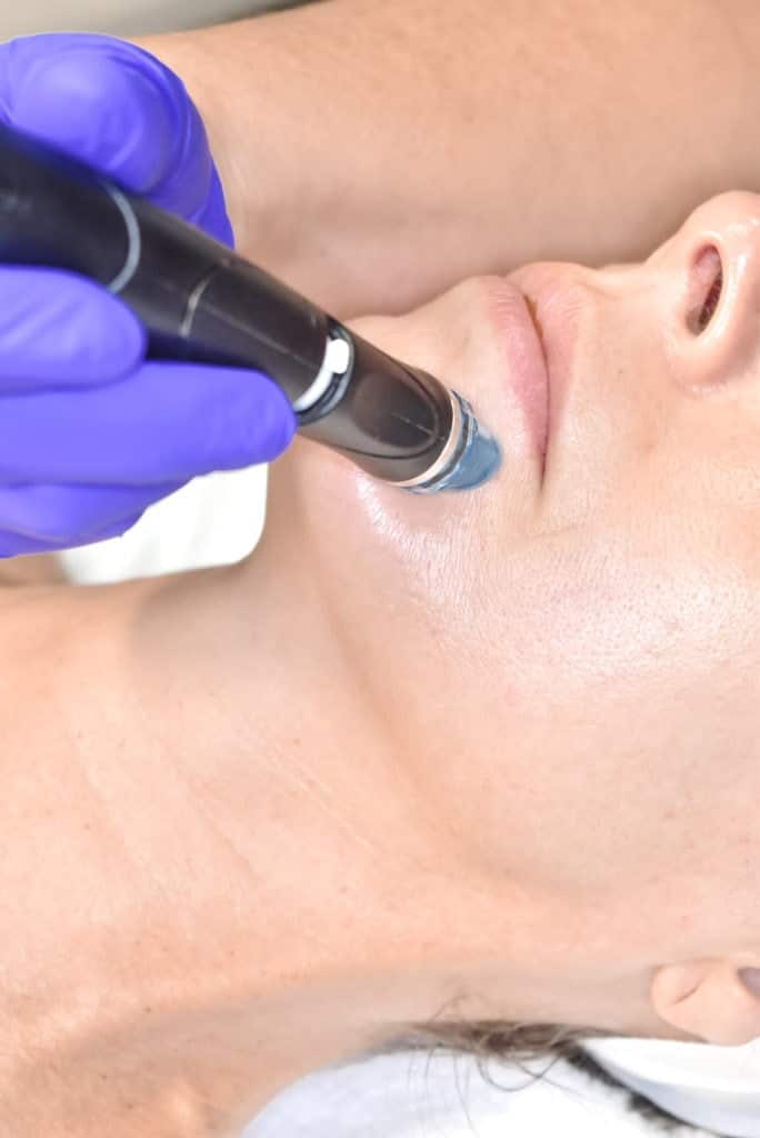 Portfolio 15 Hydrafacial Treatment in Santa Rosa Beach FL | Glow MedSpa Of 30A